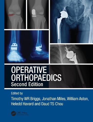 Operative Orthopaedics