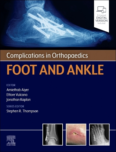 Complications in Orthopaedics: Foot and Ankle