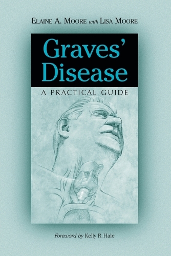 Graves' Disease