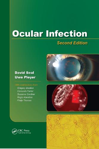 Ocular Infection
