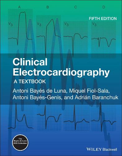 Clinical Electrocardiography