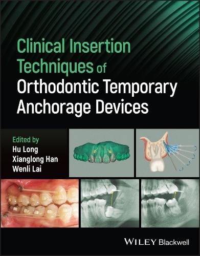 Clinical Insertion Techniques of Orthodontic Temporary Anchorage Devices