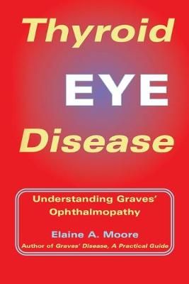 Thyroid Eye Disease