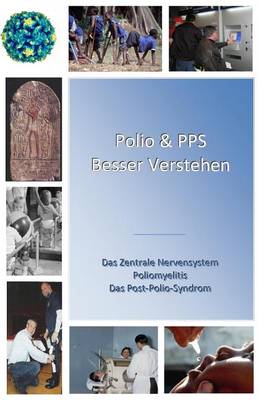 Polio & PPS Besser Verstehen