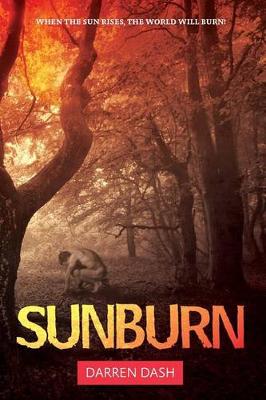 Sunburn
