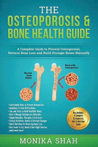 Osteoporosis