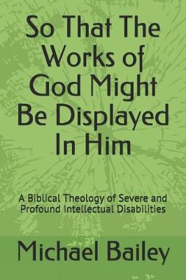 So That the Works of God Might Be Displayed in Him