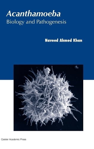 Acanthamoeba