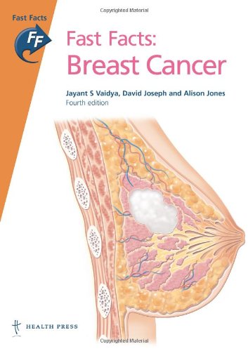 Fast Facts: Breast Cancer, fourth edition