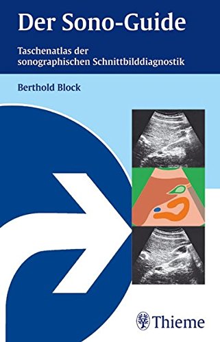 Der Sono-Guide.: Taschenatlas der sonographischen Schnittbilddiagnostik