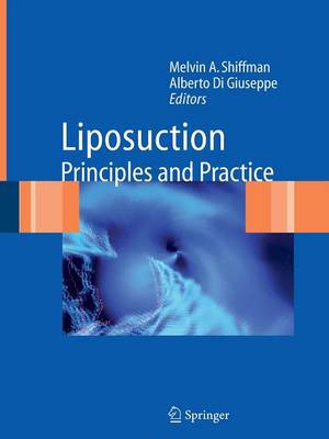 Liposuction