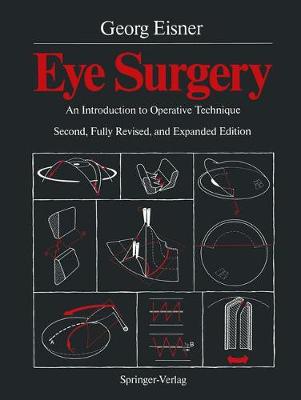 Eye Surgery