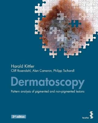Dermatoscopy