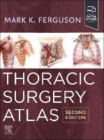 Thoracic Surgery Atlas