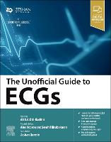 The Unofficial Guide to ECGs