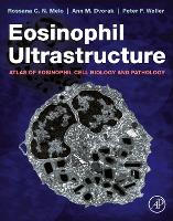 Eosinophil Ultrastructure