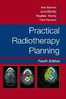 Practical Radiotherapy Planning