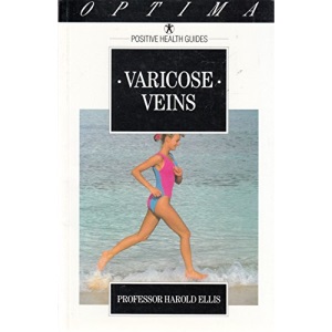 Varicose Veins: How They Are Treated and What You Can Do to Help (Positive Health Guide)