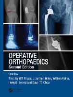 Operative Orthopaedics