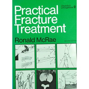 Practical Fracture Treatment