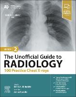 The Unofficial Guide to Radiology: 100 Practice Chest X-rays