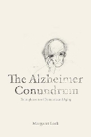 The Alzheimer Conundrum