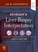 Scheuer's Liver Biopsy Interpretation