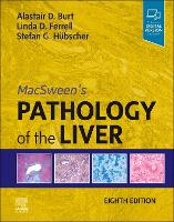 MacSween's Pathology of the Liver