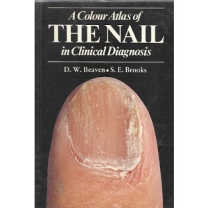 Color Atlas of the Nail in Clinical Diagnosis