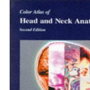 Color Atlas Of Head & Neck Anatomy