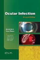 Ocular Infection