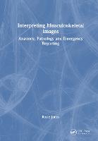 Interpreting Musculoskeletal Images