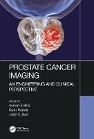 Prostate Cancer Imaging