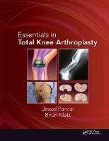 Essentials in Total Knee Arthroplasty