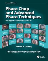 Phaco Chop and Advanced Phaco Techniques