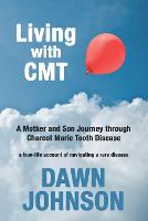 Living with CMT