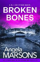 Broken Bones