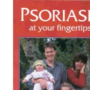 Psoriasis at Your Fingertips: The Essential Reference Guide to Dealing with Psoriasis