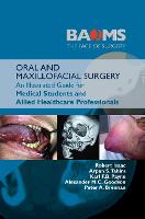 ORAL AND MAXILLOFACIAL SURGERY