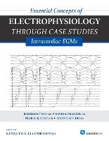 Essential Concepts of Electrophysiology Through Case Studies: Intracardiac EGMs