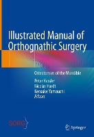 Illustrated Manual of Orthognathic Surgery