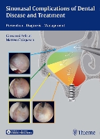 Sinonasal Complications of Dental Disease and Treatment