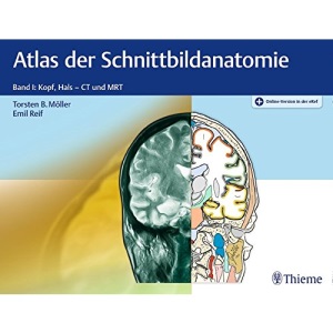 Atlas der Schnittbildanatomie. Band 01: Band I: Kopf, Hals - CT und MRT