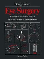 Eye Surgery
