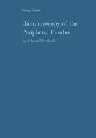 Biomicroscopy of the Peripheral Fundus
