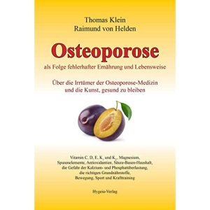 Osteoporose: als Folge fehlerhafter Ernährung und Lebensweise. Über die Irrtümer der Osteoporose-Medizin und die Kunst, gesund zu bleiben