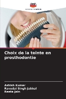 Choix de la teinte en prosthodontie