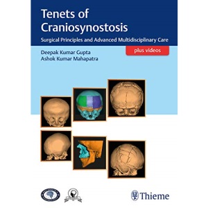 Tenets of Craniosynostosis