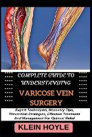 Complete Guide to Understanding Varicose Vein Surgery
