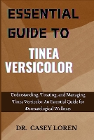 Essential Guide to Tinea Versicolor